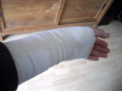 Verbundene hand
